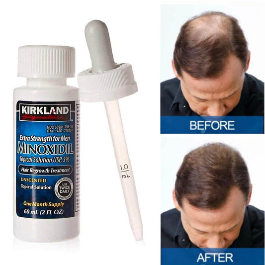 Minoxidil Kirkland 3-Month Supply + FREE Derma Roller for Hair Growth